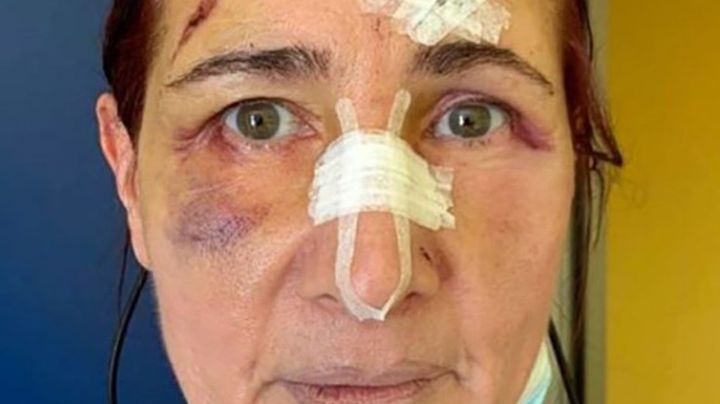 Brutal paliza: Un hombre la golpeó porque le pidió que use tapabocas