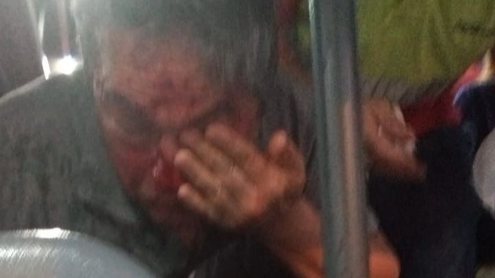Un pasajero gravemente herido tras recibir un "piedrazo" en su rostro