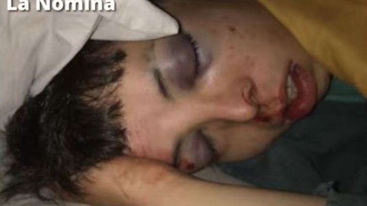 El brutal ataque en patota que sufrió un joven en el norte de Punilla