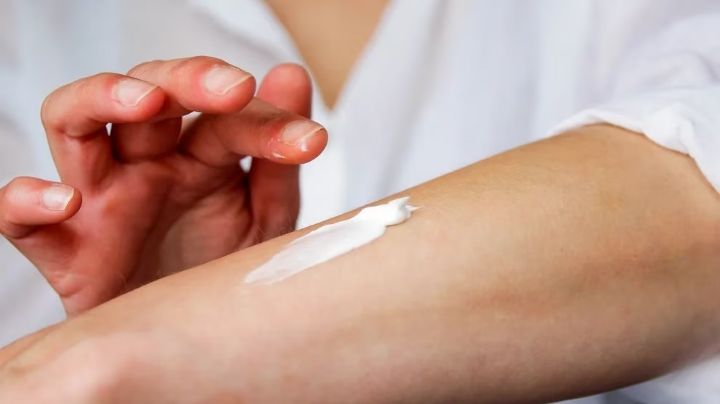 Aprobaron en Argentina nuevos tratamientos para la dermatitis atópica